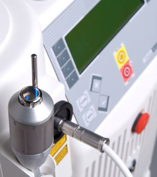 Nail fungus treatment machine in Burlington